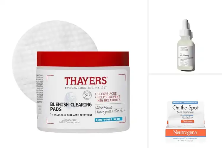 Detailed view of 10 Best Acne Blemish Treatments for Clear Skin