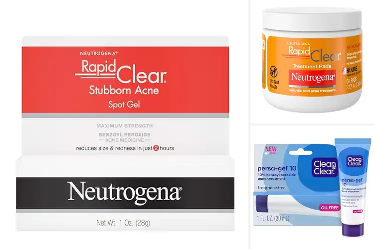 Detailed view of 10 Best Acne Clearers: Real Stories of Clear Skin