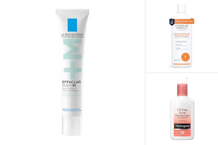 Detailed view of 10 Best Greasy Skin Treatments for Glow-Free Skin